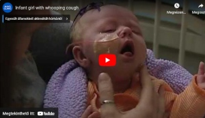 Orvosok figyelmeztetése: Ez történik egy csecsemővel, ha elkapja a szamárköhögést (videó)